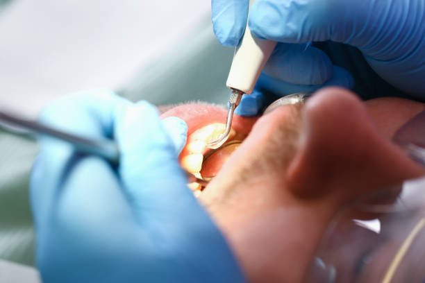 Best Pediatric Emergency Dentist in Oneonta, AL