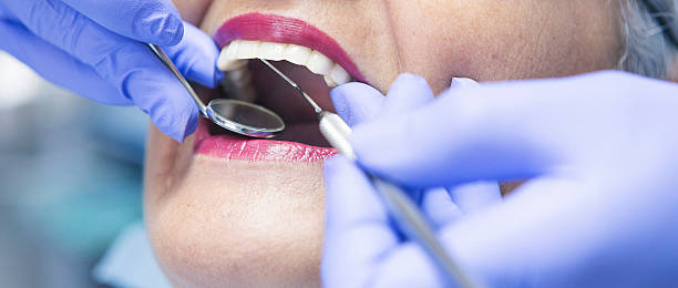 Best Emergency Dentist for Lost Fillings or Crowns in Oneonta, AL